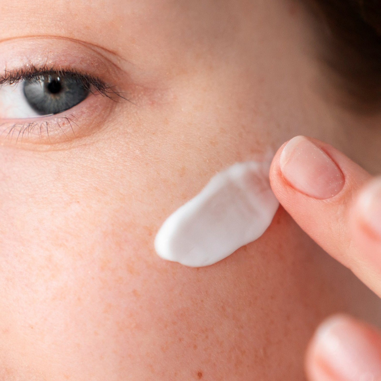 Dark Spot Skin Remover